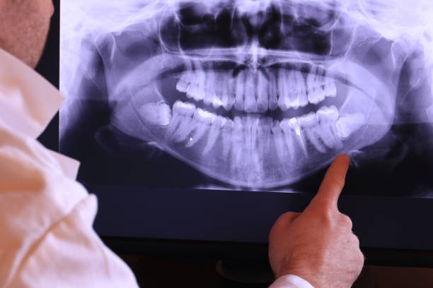 Best Mobile Emergency Dentist in Liberty, IN