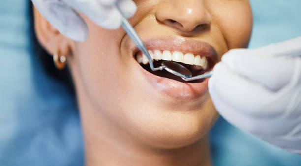 Best Emergency Dental Services for Seniors in Liberty, IN